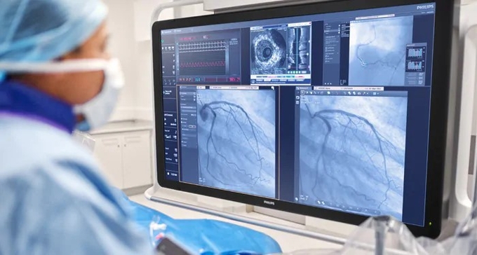 보지 않을 거면 애초에 x-ray 오더를 내지 마라는 얘기를 많이 들었다.