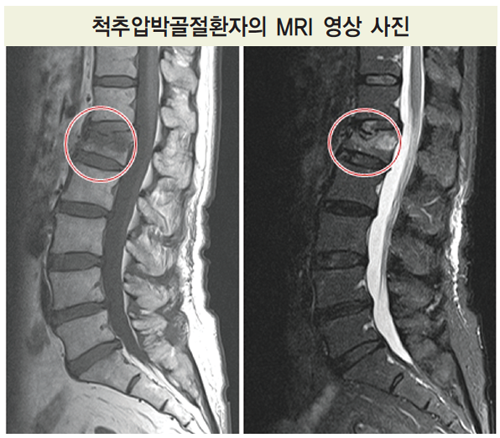  가톨릭대학교 인천성모병원 자료 (출처: 백세시대)
