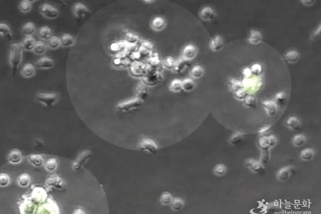 우리 몸 자가 면역력 막강해 진다